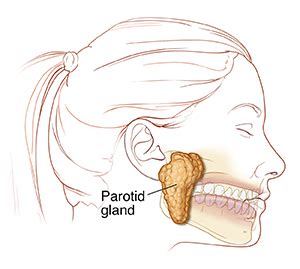 blocked prada gland|Understanding Parotid Duct Obstruction .